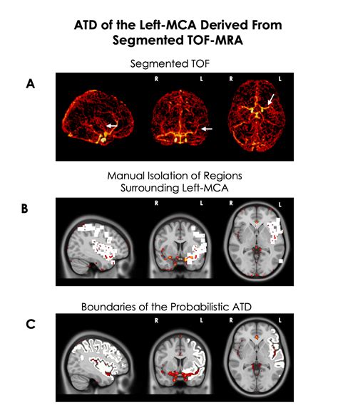 fsl neuroimage.